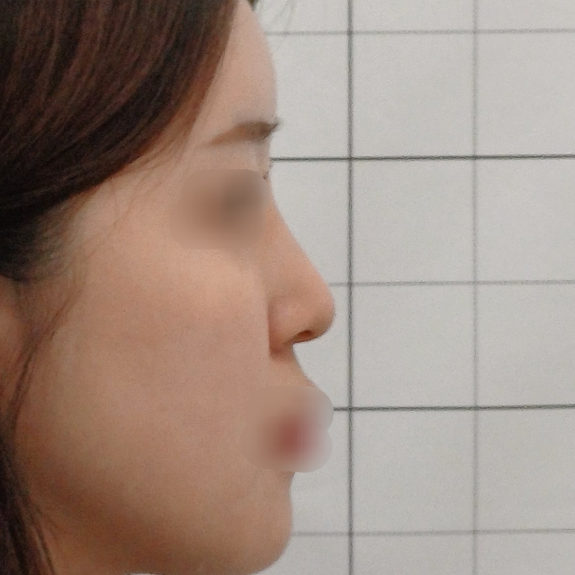 비앙코 코프팅 비포 이미지